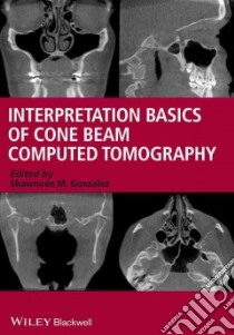 Interpretation Basics of Cone Beam Computed Tomography libro in lingua di Gonzalez Shawneen M. (EDT)