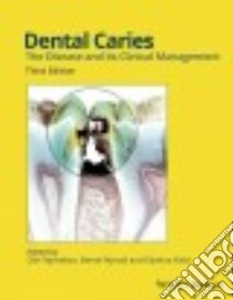 Dental Caries libro in lingua di Fejerskov Ole (EDT), Nyvad Bente (EDT), Kidd Edwina (EDT)