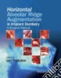 Horizontal Alveolar Ridge Augmentation in Implant Dentistry libro in lingua di Tolstunov Len (EDT)