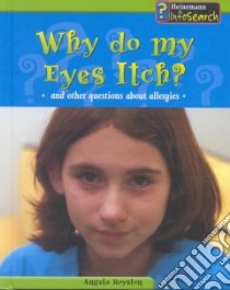 Why Do My Eyes Itch? libro in lingua di Royston Angela