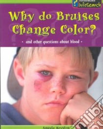 Why Do Bruises Change Color? libro in lingua di Royston Angela