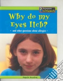Why Do My Eyes Itch libro in lingua di Royston Angela