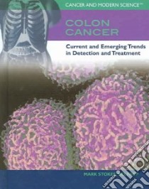 Colon Cancer libro in lingua di Stokes Mark M.D.