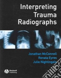 Interpreting Trauma Radiographs libro in lingua di Renata Eyres