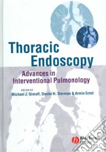 Thoracic Endoscopy libro in lingua di Simoff Michael J. M.D. (EDT), Sterman Daniel H. M.D. (EDT), Ernst Armin