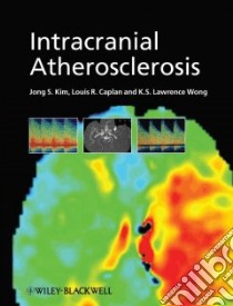 Intracranial Atherosclerosis libro in lingua di Kim Jong S. (EDT), Caplan Louis R. (EDT), Wong K. S. Larewnce (EDT), Donnan Geoffrey A. M.D. (FRW)