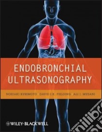 Endobronchial Ultrasonography libro in lingua di Kurimoto Noriaki, Fielding David I. K. M.D., Musani Ali I. M.D.