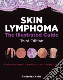 Skin Lymphoma libro in lingua di Cerroni Lorenzo, Gatter Kevin, Helmut Kerl