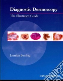Diagnostic Dermoscopy libro in lingua di Bowling Jonathan