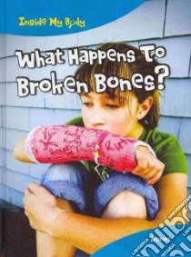 What Happens to Broken Bones? libro in lingua di Ballard Carol