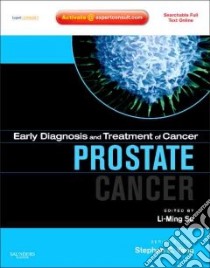 Prostate Cancer libro in lingua di Li-Ming Su