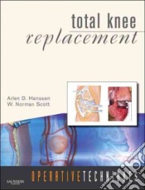 Total Knee Replacement libro in lingua di Hanssen Arlen D. M.D., Scott W. Norman