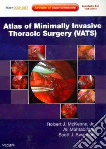 Atlas of Minimally Invasive Thoracic Surgery Vats libro in lingua di Mckenna Robert J. Jr. M.D., Mahtabifard Ali M.D., Swanson Scott J. M.D.