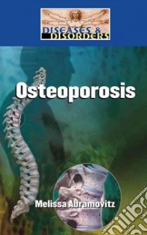 Osteoporosis libro in lingua di Abramovitz Melissa