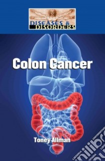 Colon Cancer libro in lingua di Allman Toney