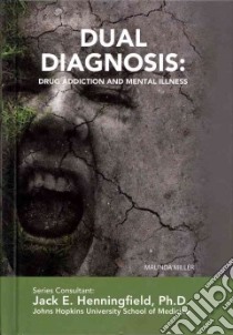 Dual Diagnosis libro in lingua di Miller Malinda