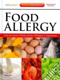 Food Allergy libro in lingua di James John M. M.D., Burks Wesley M.D., Eigenmann Philippe M.D.
