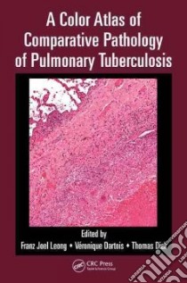 A Color Atlas of Comparative Pathology of Pulmonary Tuberculosis libro in lingua di Leong Franz Joel (EDT), Dartois Veronique (EDT), Dick Thomas (EDT)