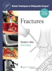 Fractures libro in lingua di Wiss Donald A. M.D. (EDT)