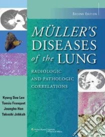 Muller's Diseases of the Lung libro in lingua di Lee Kyung Soo M.D. Ph.D., Franquet Tomas, Han Joungho, Johkoh Takeshi M.D. Ph.D.