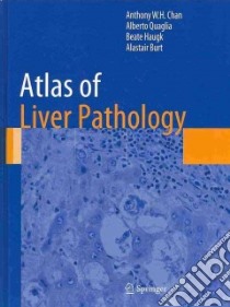 Atlas of Liver Pathology libro in lingua di Chan Anthony W. H., Quaglia Alberto, Haugk Beate, Burt Alastair