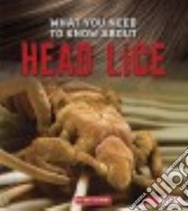What You Need to Know About Head Lice libro in lingua di Dickmann Nancy
