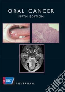 Oral Cancer libro in lingua di Silverman Sol (EDT), Silverman Sol, American Cancer Society (COR)