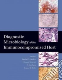 Diagnostic Microbiology of the Immunocompromised Host libro in lingua di Hayden Randall T. (EDT), Tang Yi-Wei (EDT), Wolk Donna M. (EDT)
