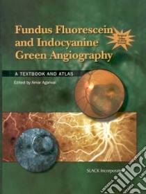 Fundus Fluorescein and Indocyanine Green Angiography libro in lingua di Agarwal Amar (EDT)