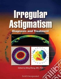 Irregular Astigmatism libro in lingua di Wang Ming (EDT), Swartz Tracy Schroeder (EDT)