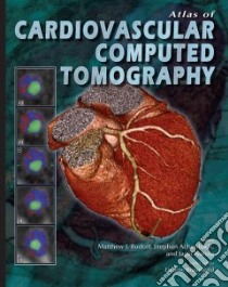 Atlas of Cardiovascular Computed Tomography libro in lingua di Not Available (NA)