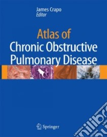 Atlas of Chronic Obstructive Pulmonary Disease libro in lingua di Crapo James D. (EDT)