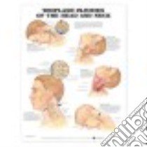 Whiplash Injuries Of Head & Neck Chart libro in lingua di Not Available (NA)