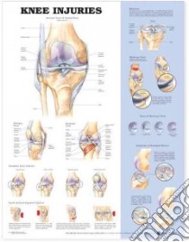 Knee Injuries Anatomical Chart libro in lingua di Anatomical Chart Company (EDT)