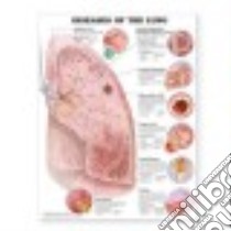 Diseases of the Lung Anatomical Chart libro in lingua di Anatomical Chart Company (COR)