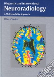 Diagnostic and Interventional Neuroradiology libro in lingua di Sartor Klaus, Albrecht G., Atzor K. R., Bien S., Bockenheimer St., Bruckmann H. (CON), Deinzer M. (CON), Dietrich B. (CON)