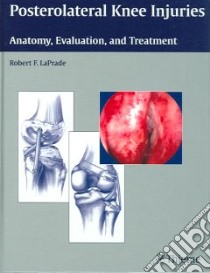 Posterolateral Knee Injuries libro in lingua di LaPrade Robert F. M.D. Ph.D.