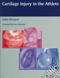 Cartilage Injury in the Athlete libro in lingua di Mirzayan Raffy (EDT)