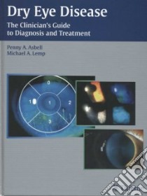 Dry Eye Disease libro in lingua di Asbell Penny (EDT), Lemp Michael (EDT)