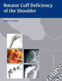 Rotator Cuff Deficiency of the Shoulder libro in lingua di Frankle Mark A. M.D. (EDT)