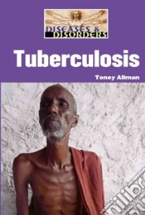 Tuberculosis libro in lingua di Allman Toney