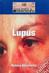 Lupus libro in lingua di Abramovitz Melissa