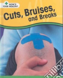 Cuts, Bruises, and Breaks libro in lingua di Royston Angela