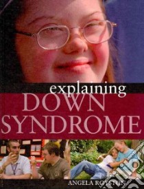 Explaining Down Syndrome libro in lingua di Royston Angela