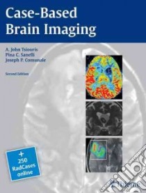 Case-Based Brain Imaging libro in lingua di Tsiouris A. John M.D., Sanelli Pina C. M.D., Comunale Joseph P. M.D.