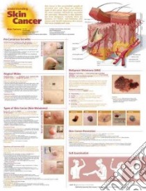 Understanding Skin Cancer libro in lingua di Anatomical Chart Company (COR)