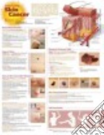 Understanding Skin Cancer Anatomical Chart libro in lingua di Anatomical Chart Company (COR)