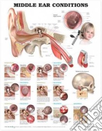 Middle Ear Conditions Anatomical Chart libro in lingua di Anatomical Chart Company