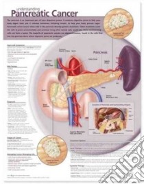 Understanding Pancreatic Cancer libro in lingua di Anatomical Chart Company (COR)