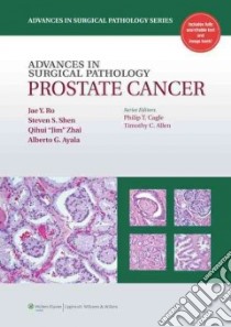 Advances in Surgical Pathology: Prostate Cancer libro in lingua di Jae Y Ro